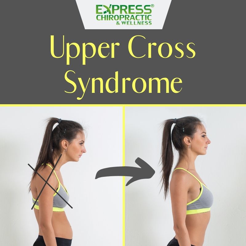 upper cross syndrome frisco chiropractor