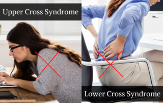 upper and lower cross syndrome